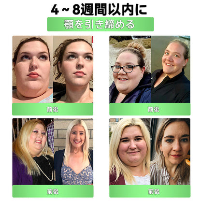 🔥DOTALE® 残りわずか 5 箱のみ！追加で 30％オフの特別割引をご用意しました。 気になるイボをケアし、滑らかな素肌を手に入れましょう。 今逃すと、来年までこのチャンスは訪れません。